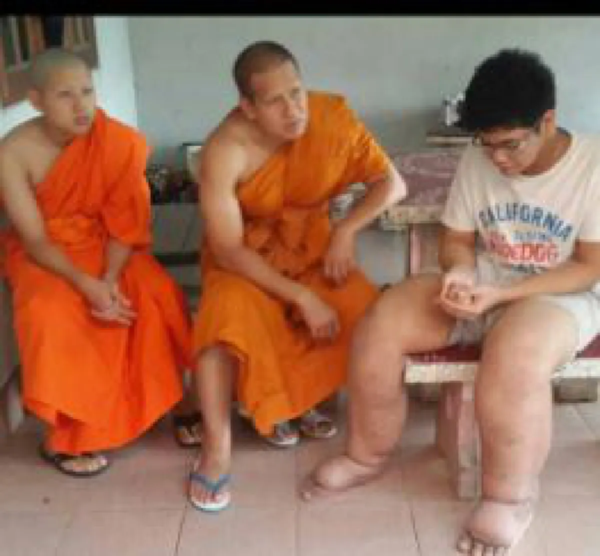 อนุโมทนา...สาธุ !!! "พระบิณฑ์"รุดช่วยหนุ่มวัย16 ปีป่วยโรคเท้าช้างใช้เงินรักษาจนแม่หมดตังค์ เสียดายสุดๆเรียนเก่งสอบได้ที่1แต่วันนี้ต้องหยุด? 