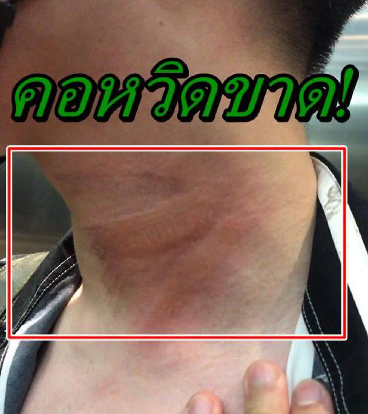 สายเคเบิล ห้อยกลางถนน บาดคอ หนุ่มนักศึกษา