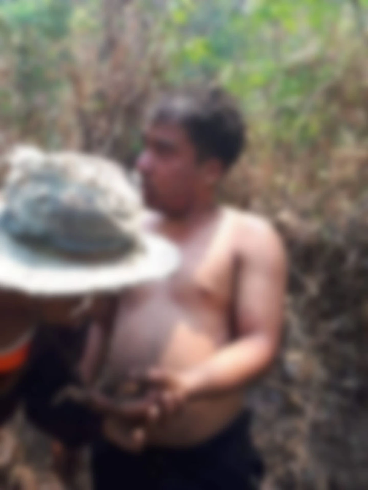 อาล่องจิตอาสาช่วยดับไฟป่า จนตัวเองบาดเจ็บสาหัส