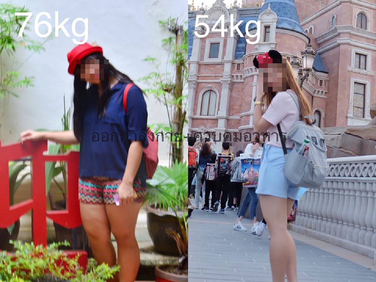 สาวรีวิวลดน้ำหนักจากเด็กหญิงอ้วนเป็นหุ่นสวยสุขภาพดี