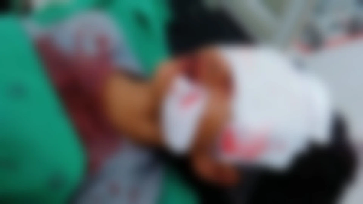 สาวขับรถไปชนเสาไฟ กระจกรถหน้าแตก กระจกบาททั้งหน้า 