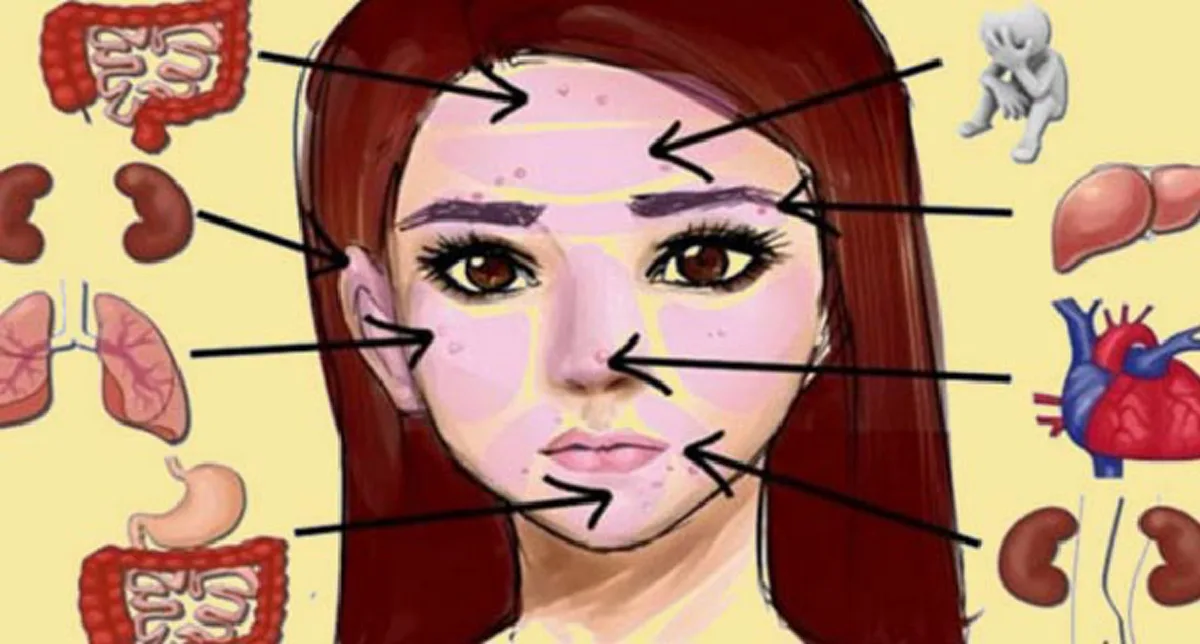 รู้ไว้ดีกว่าไม่รู้ !! ตำแหน่งสิวบนใบหน้า สามารถบอกได้ว่าคุณเป็นอะไร ?