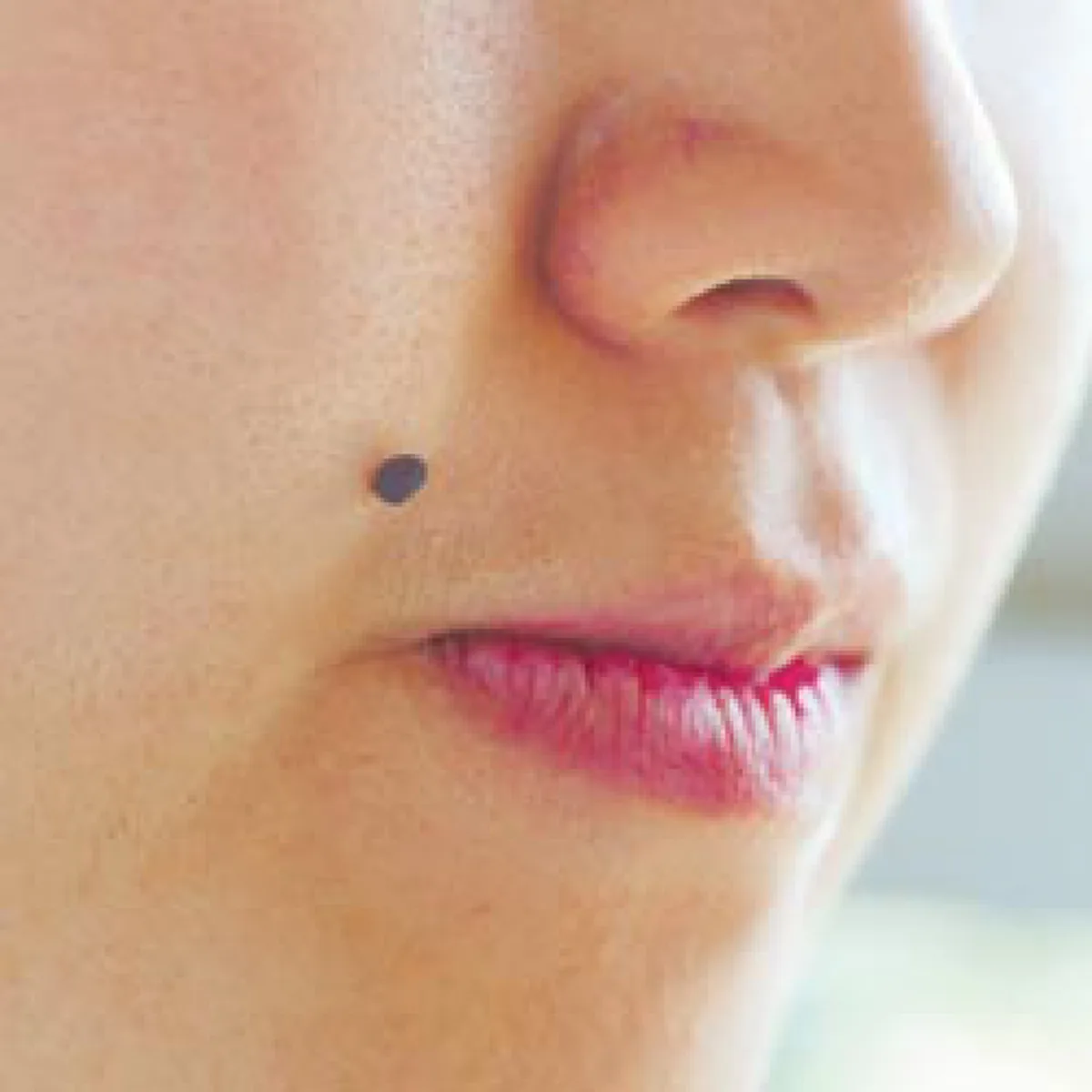 สุดยอดมากๆ!!! แนะนำเคล็ดลับกำจัดไฝและขี้แมลงวันง่ายๆ ใช้เงินไม่ถึง 20 บาท รีบอ่านด่วนเลย!!!