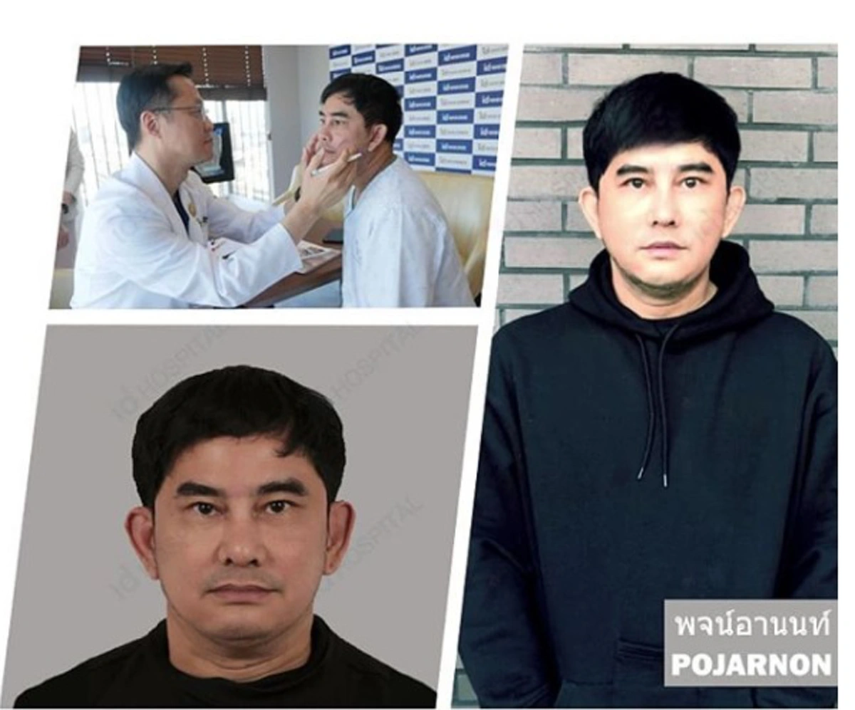 ซูมชัดๆ!!! เปิดหน้าใหม่ "พจน์ อานนท์" หลังบินไปอัพหน้าที่เกาหลี ดูเป๊ะปังมาก โอปป้าเว่อร์ !!!