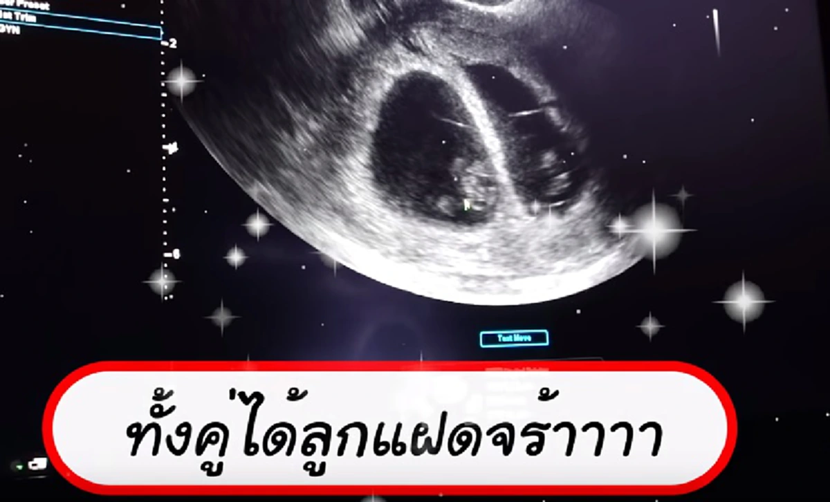 ป๊อก ภัสสรกรณ์ โพสต์IG ฉลองแต่งงาน 1 กับมาร์กี้ ราศี บอกปีสุดท้ายที่จะมีแค่เรา2คน