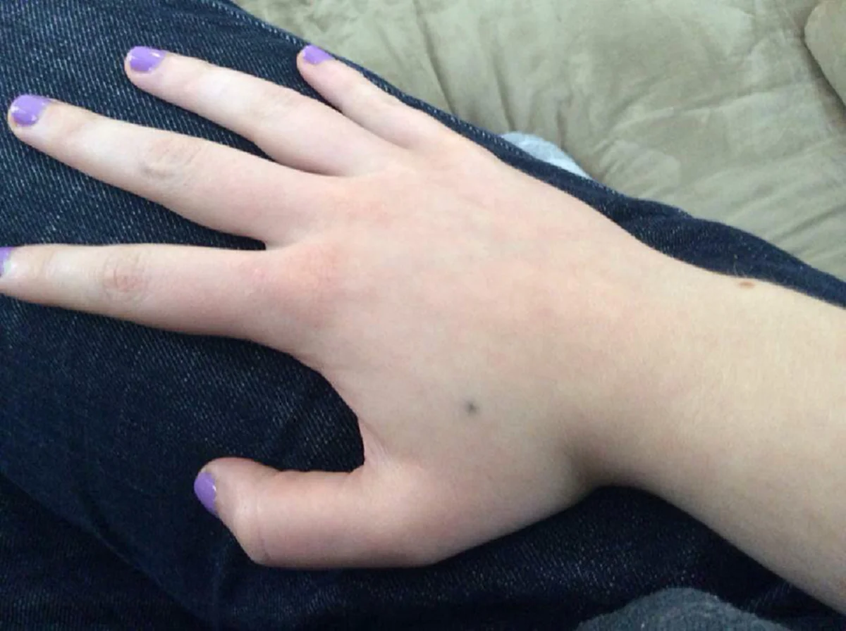 ชาวเน็ตแชร์รูป รอยสักที่เกิดจากการ โดนดินสอทิ่ม และมันยังติดตัวเราจนถึงทุกวันนี้