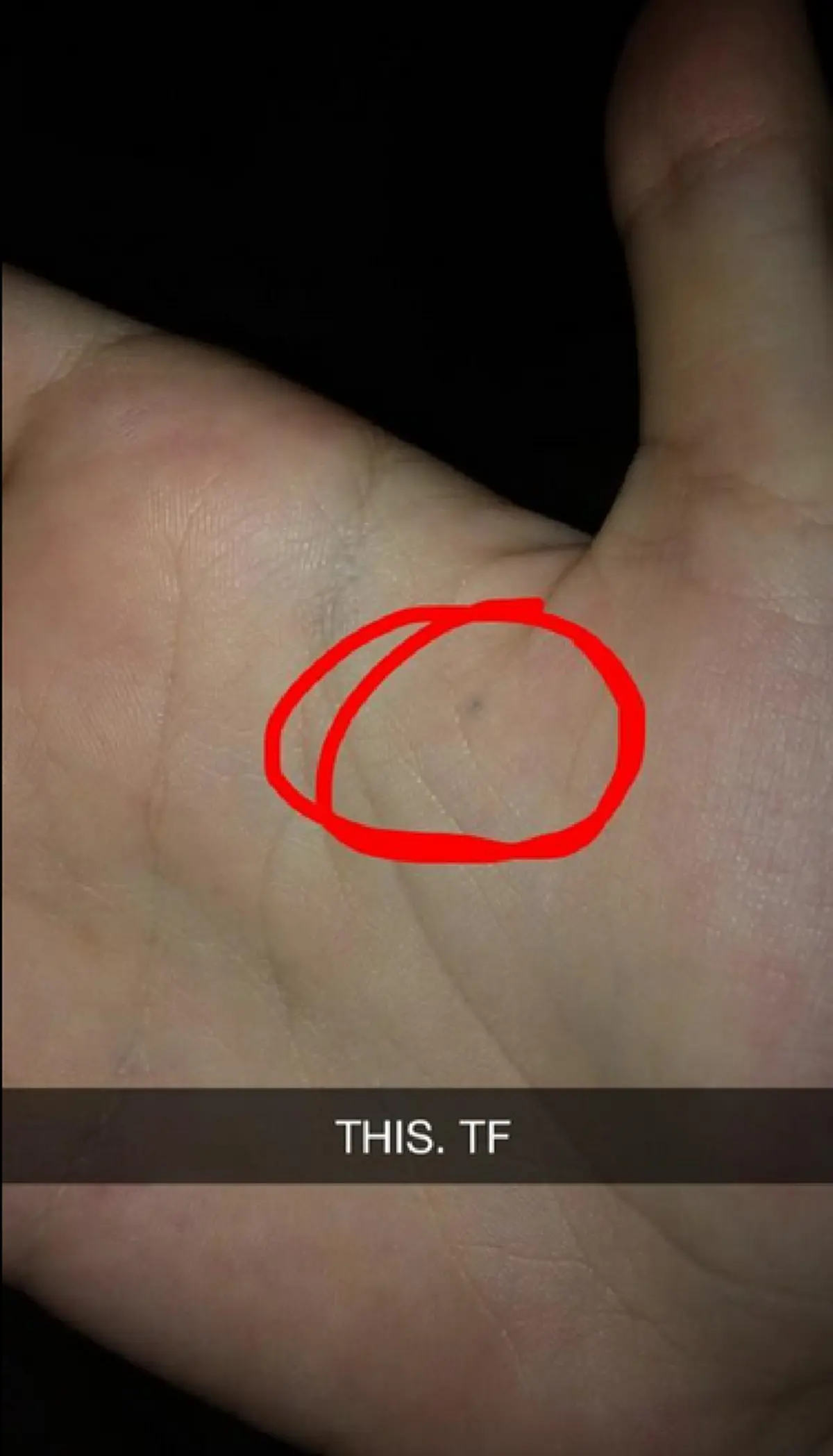 ชาวเน็ตแชร์รูป รอยสักที่เกิดจากการ โดนดินสอทิ่ม และมันยังติดตัวเราจนถึงทุกวันนี้