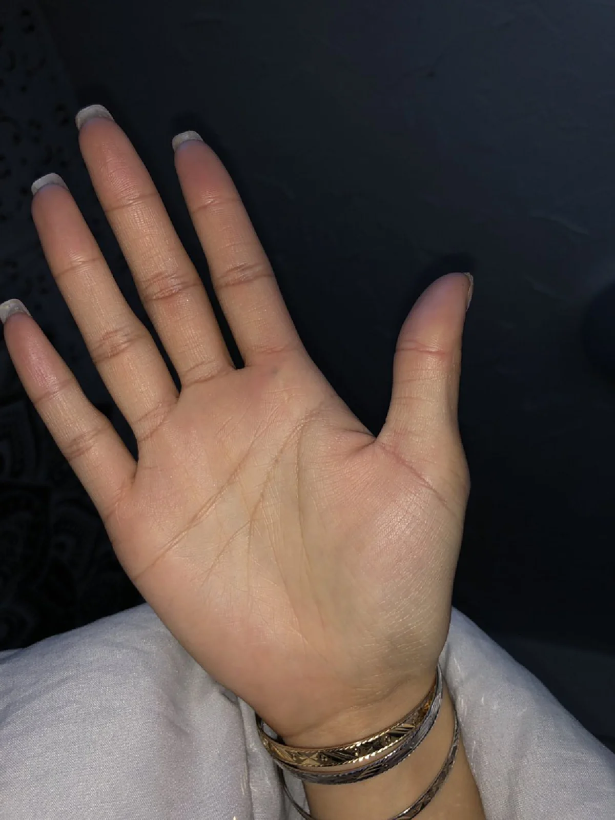 ชาวเน็ตแชร์รูป รอยสักที่เกิดจากการ โดนดินสอทิ่ม และมันยังติดตัวเราจนถึงทุกวันนี้