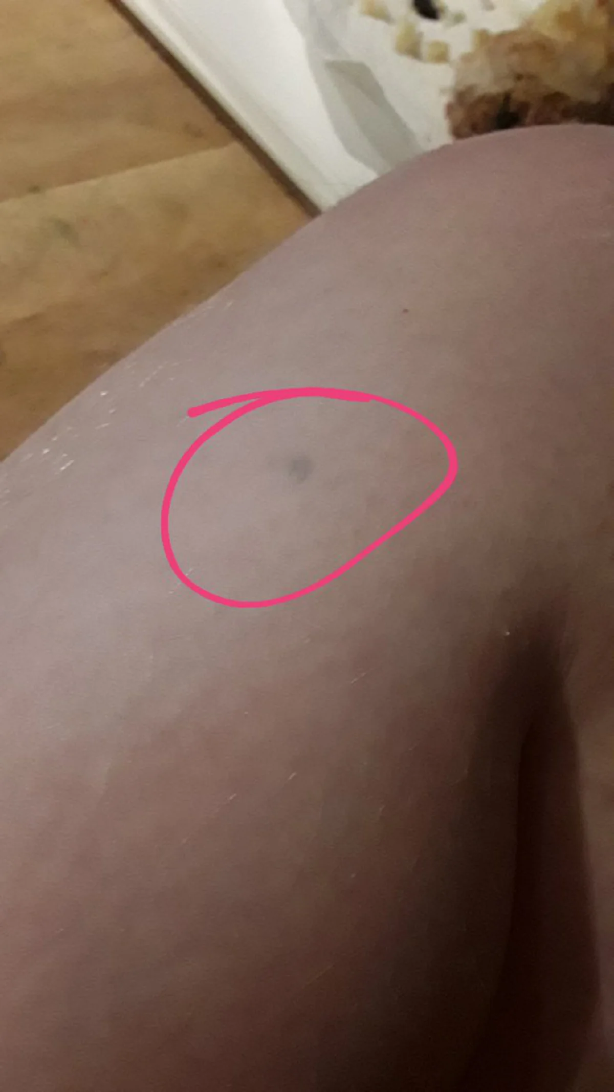 ชาวเน็ตแชร์รูป รอยสักที่เกิดจากการ โดนดินสอทิ่ม และมันยังติดตัวเราจนถึงทุกวันนี้