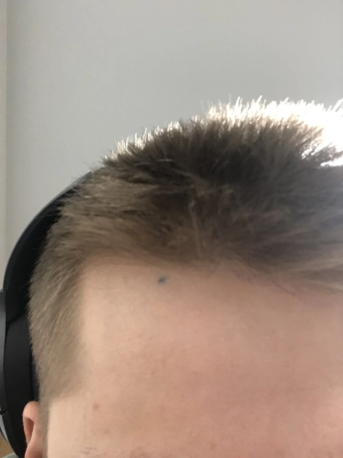 ชาวเน็ตแชร์รูป รอยสักที่เกิดจากการ โดนดินสอทิ่ม และมันยังติดตัวเราจนถึงทุกวันนี้