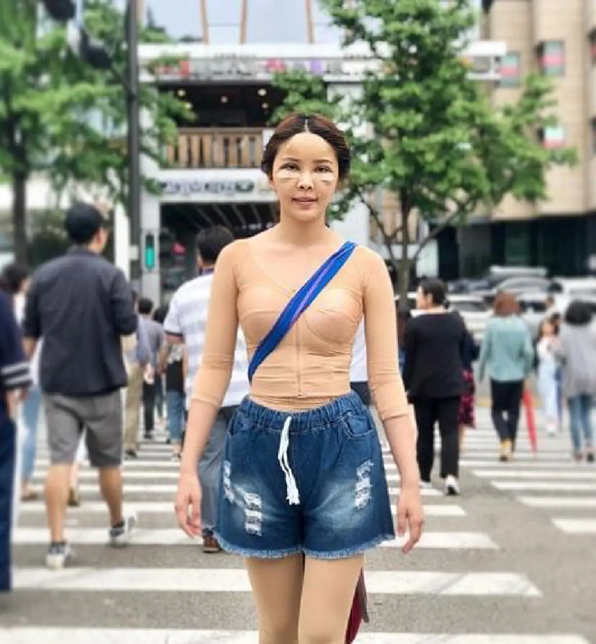 เริ่มดีขึ้นแล้ว! ส่องภาพ "หญิงแย้" อัพเดตร่างกายล่าสุด หลังทำศัลยกรรมทั้งตัว ไม่ได้อาบน้ำมา 15 วัน! (ชมคลิป)