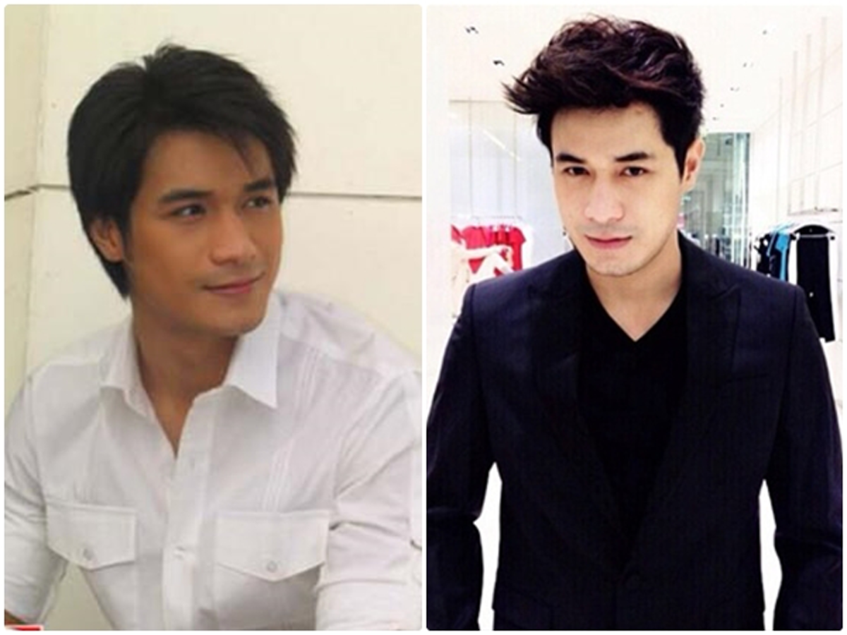 #เห็นแล้วแทบช็อก!! เปิดโผ 13 ดาราชาย “ศัลยกรรมพลิกชีวิต” เห็นแล้วอึ้งตาค้าง แทบจำไม่ได้ !! (ภาพชุด)