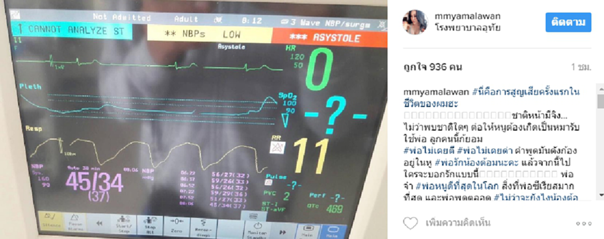 ปาฏิหาริย์ไม่มีจริง!!! เอมมี่ แม็กซิม สุดเศร้า! หลัง "คุณพ่อ" สิ้นใจอย่างสงบ ชาติหน้ามีจริงขอเกิดเป็นลูกพ่อ!!!