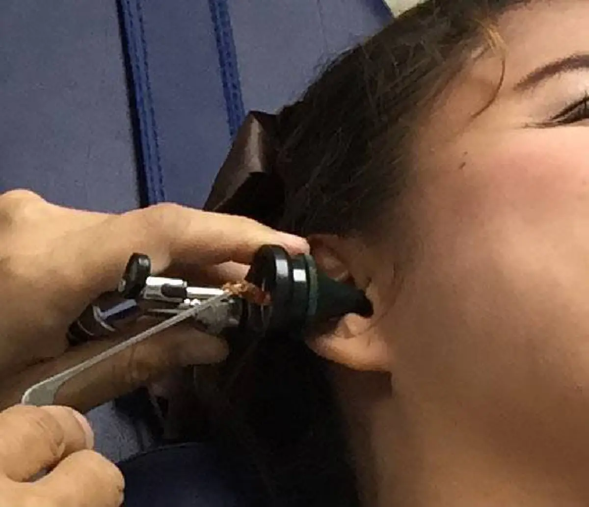 #แพทย์เตือนแล้ว!! "ขี้หู" เปียก-แห้ง แบบไหนกัน ที่เสี่ยงเป็นมะเร็ง อันตรายถึงชีวิต เช็คด่วน! ก่อนจะสายเกินแก้ เอาตัวรอดแทบไม่ทัน !! (ชมคลิป