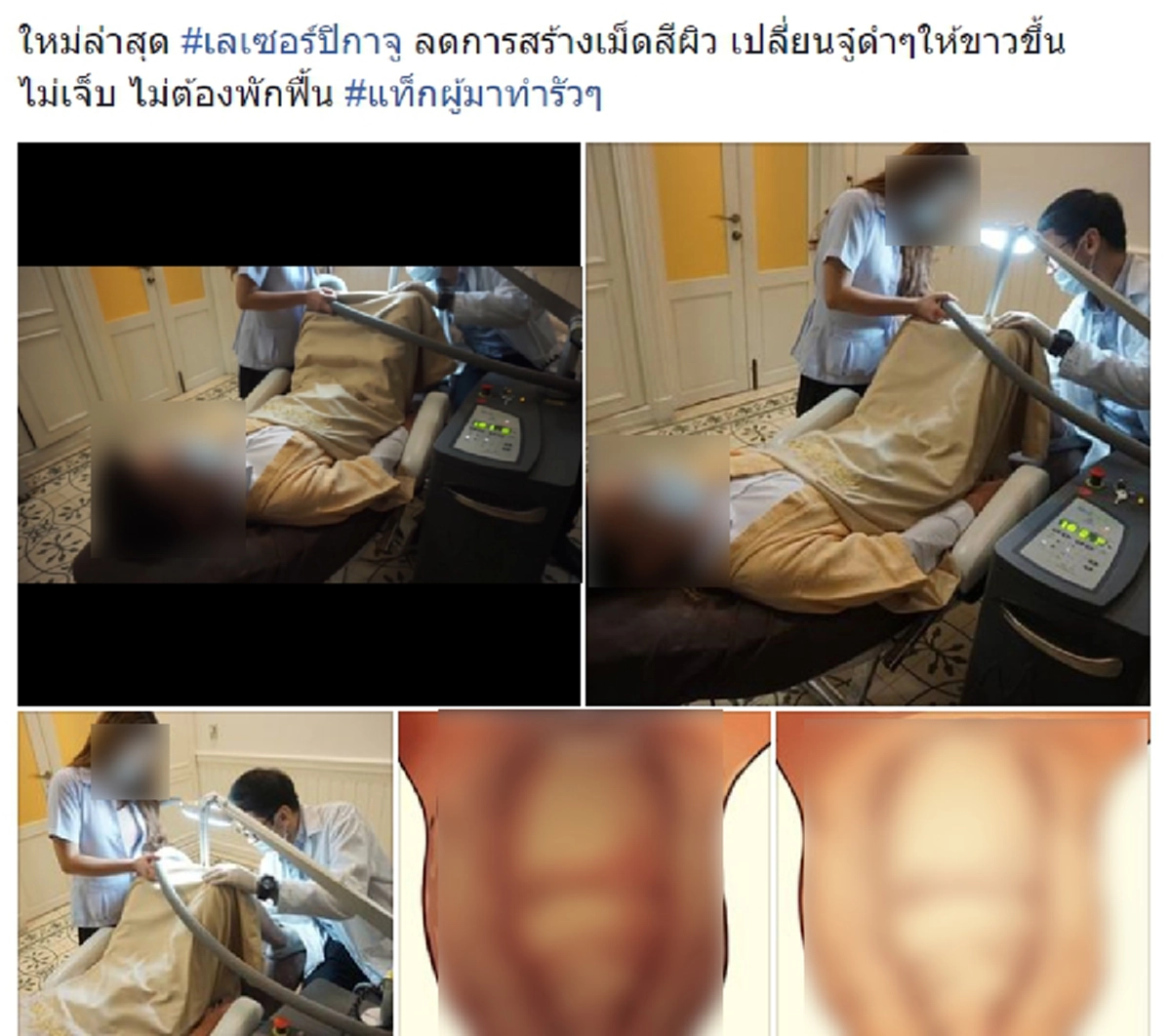 ตะแบงไปก็เท่านั้น!! รพ.ดังโบ้ยไม่ได้สั่งแพร่ภาพเลเซอร์ปิกาจู้ โยนผิดจนท.การตลาด สบส.สั่งฟัน! เตือนแล้วไม่ฟังฝืนละเมิดซ้ำซาก!??