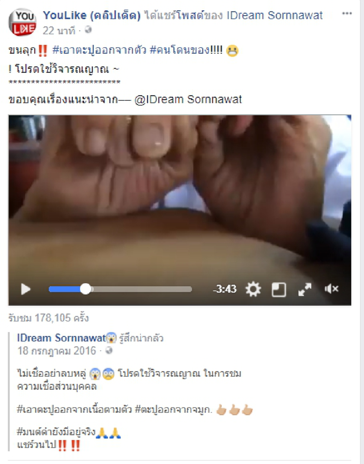 ขนลุก!! เปิดคลิปสุดพิศวง คุณยายใช้มือเปล่าดึงเอาตะปูออกจากผิวหนังคนโดนของ ชาวเน็ตวิจารณ์สนั่นโซเชียล ของจริงหรือของปลอม?! (มีคลิป)