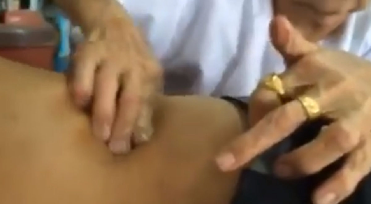 ขนลุก!! เปิดคลิปสุดพิศวง คุณยายใช้มือเปล่าดึงเอาตะปูออกจากผิวหนังคนโดนของ ชาวเน็ตวิจารณ์สนั่นโซเชียล ของจริงหรือของปลอม?! (มีคลิป)