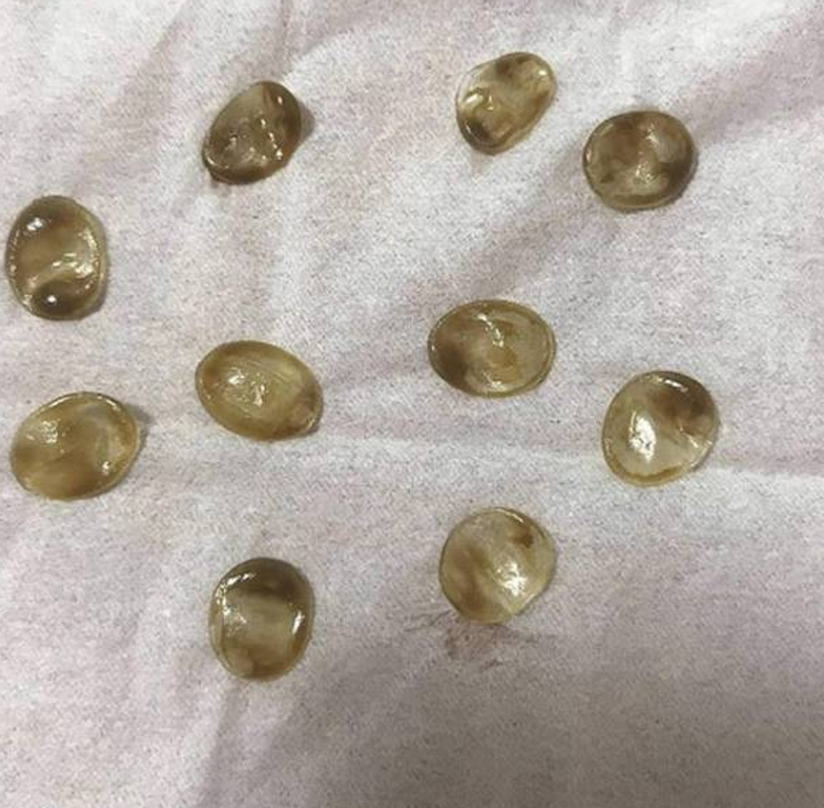 สาวญี่ปุ่นโพสต์โชว์ "อุจจาระออกมาเป็นเพชร" ดีใจถึงกับบอกว่ารวยแล้ว สุดท้ายมีเงิบเมื่อผู้เชี่ยวชาญออกมาเฉลย...!!!!!