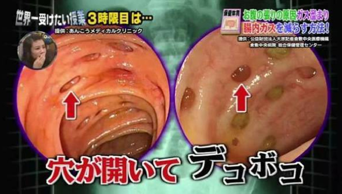 สาวญี่ปุ่นโพสต์โชว์ "อุจจาระออกมาเป็นเพชร" ดีใจถึงกับบอกว่ารวยแล้ว สุดท้ายมีเงิบเมื่อผู้เชี่ยวชาญออกมาเฉลย...!!!!!