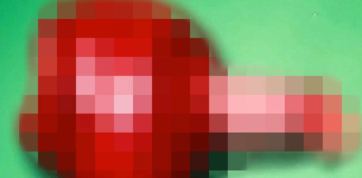 ผวาสุดขีด! หนุ่มจีน ลำไส้ร่วงออกจากทวารหนัก หลังนั่งถ่ายทุกข์แล้วเล่นมือถือจนเพลิน ในห้องน้ำนานกว่าครึ่งชั่วโมง (คลิป)