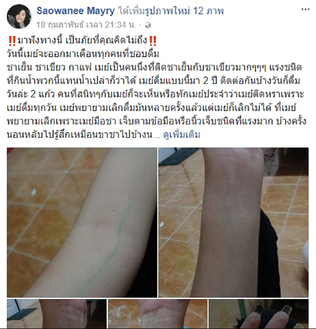 สาวแชร์ประสบการณ์ ภัยที่คุณคิดไม่ถึง!!! สำหรับคนที่ชอบดื่ม ชาเย็น ชาเขียว กาแฟ ทำร่างกายผิดปกติเกือบถึงแก่ชีวิต!!!