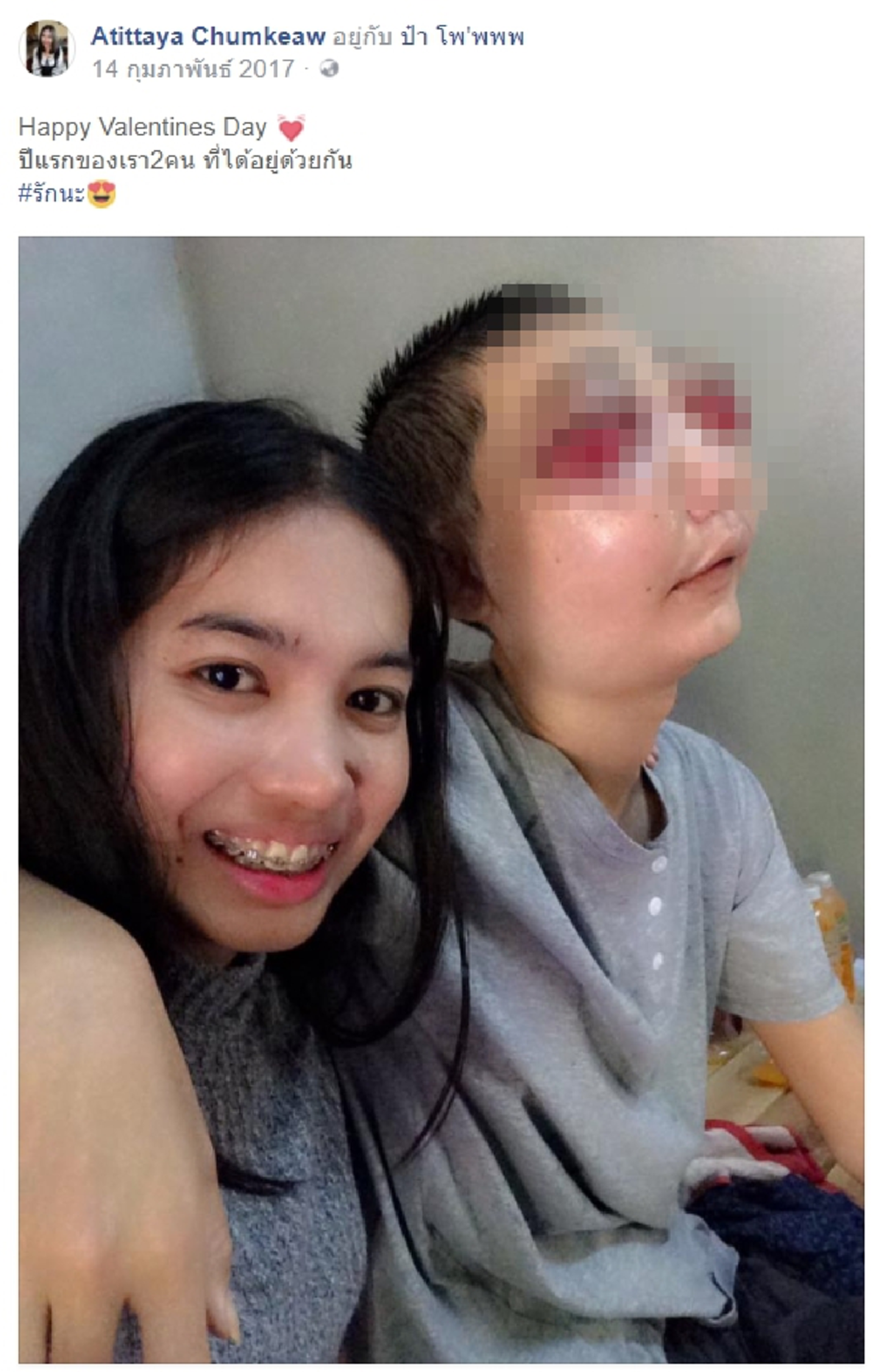เปิดไทม์ไลน์รักสุดซึ้ง!! สาว "อาทิตยา" กับหนุ่ม "โพ" ถึงรู้ป่วยมะเร็งตาไม่คิดหนีหาย แต่ละสิ่งมอบทำให้ฝ่ายชายคนทั้งโลกต้องยอมกราบหัวใจเธอ!??