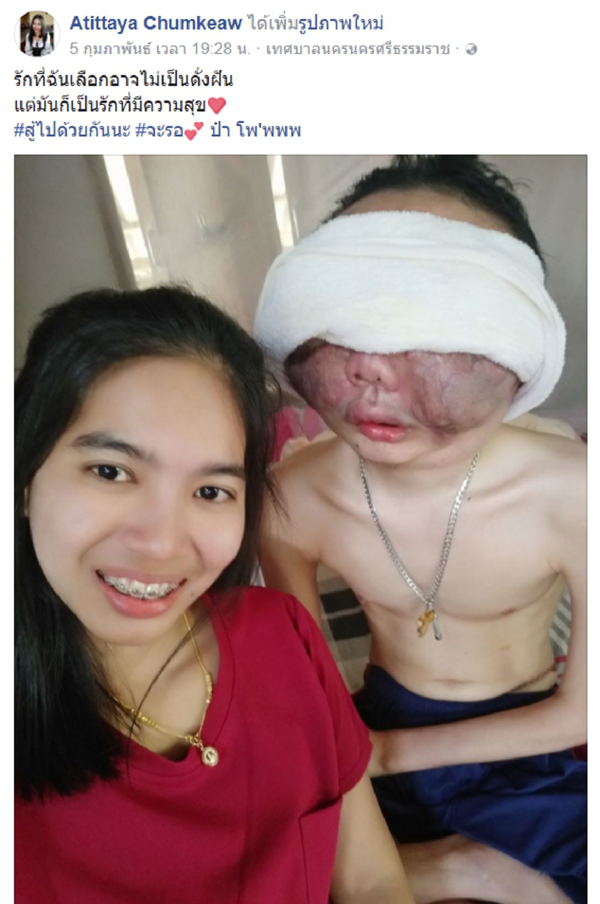 เปิดไทม์ไลน์รักสุดซึ้ง!! สาว "อาทิตยา" กับหนุ่ม "โพ" ถึงรู้ป่วยมะเร็งตาไม่คิดหนีหาย แต่ละสิ่งมอบทำให้ฝ่ายชายคนทั้งโลกต้องยอมกราบหัวใจเธอ!??