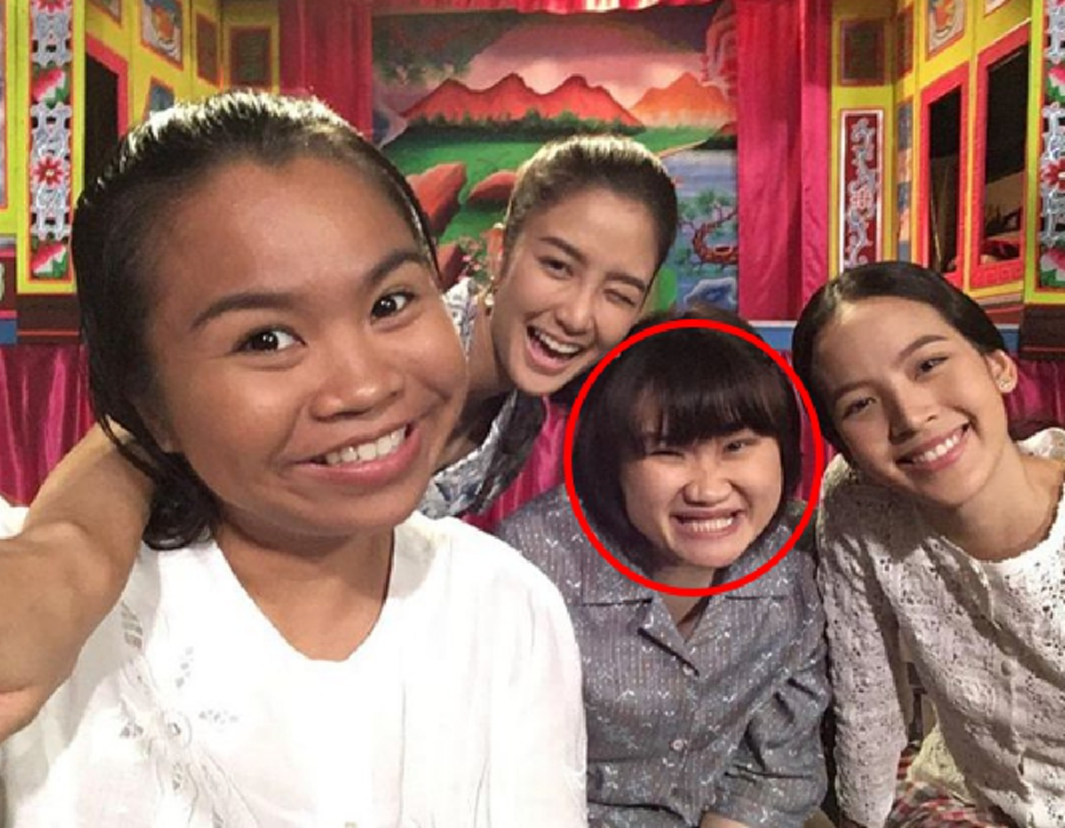 *เปิดปมฝังใจ!!! "ดาราตลกสาว" ถูกล้อ "หน้าแปลกประหลาด-ไม่สวย"เป็นประจำ ตั้งแต่เด็กยันโต พอโดนหนักซ้ำๆ จนอยาก "ตาย"!!! (เนื้อหา)