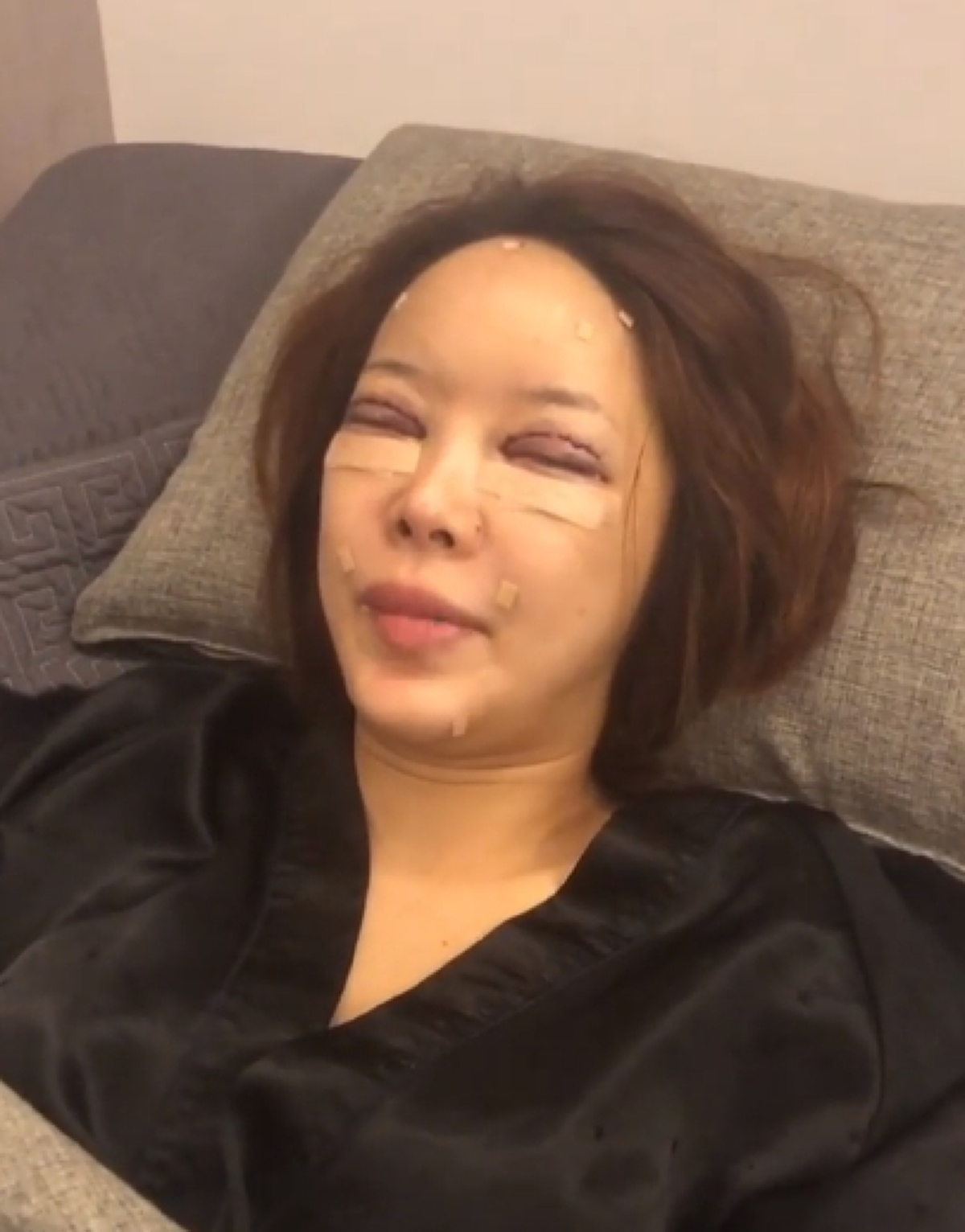 *สวยสะพรึง!!! "บล๊อกเกอร์ชื่อดัง"ดีกรีพริตตี้เงินล้าน ย่องเงียบศัลยกรรมทั้งหน้า โชว์สดๆ "หน้าบวมเป้ง" แทบไม่เหลือเค้าโครงเดิม!!! (ชมคลิป)