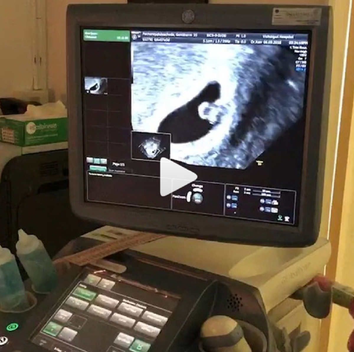 เปิดใจครั้งแรก "ศรราม" ชื่นมื่นรัก "สาวติ๊ก" คือคนที่ใช่.. "ป๋าเดียร์" มาเข้าฝันบอกเรื่องลูก