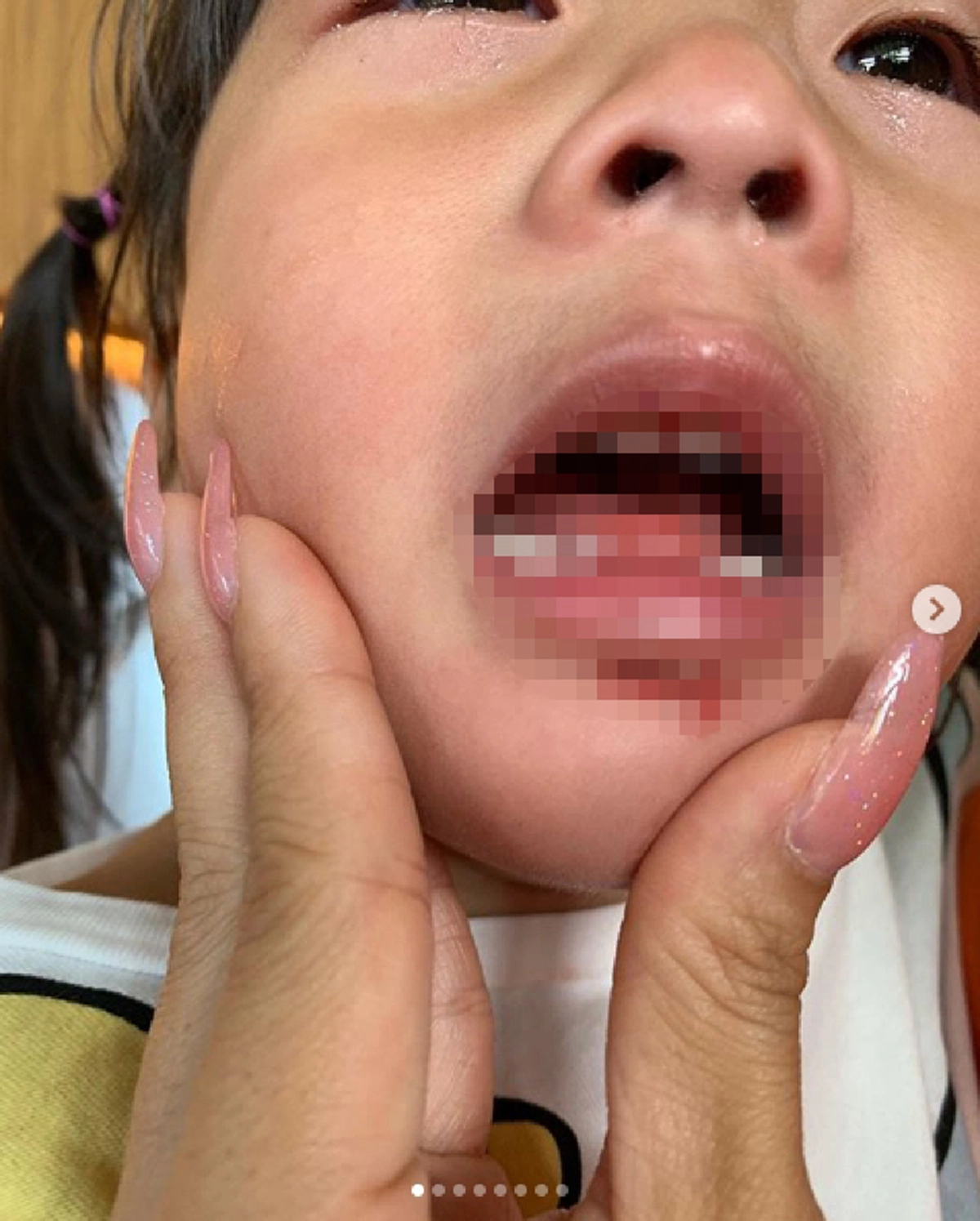 เปาเป่าปากแตก