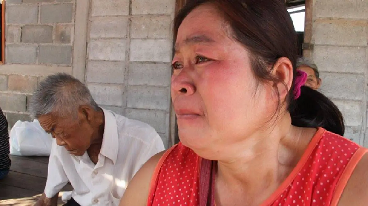 สุดช็อค..วงการแพทย์!!คุณตาวัย 73 ถูกผึ้งแค่ 1 ตัวต่อยที่เท้า ผ่านไป 4 เดือนขาเน่าเหวอะ จนเห็นกระดูก ต้องตัดขาสถานเดียว!!