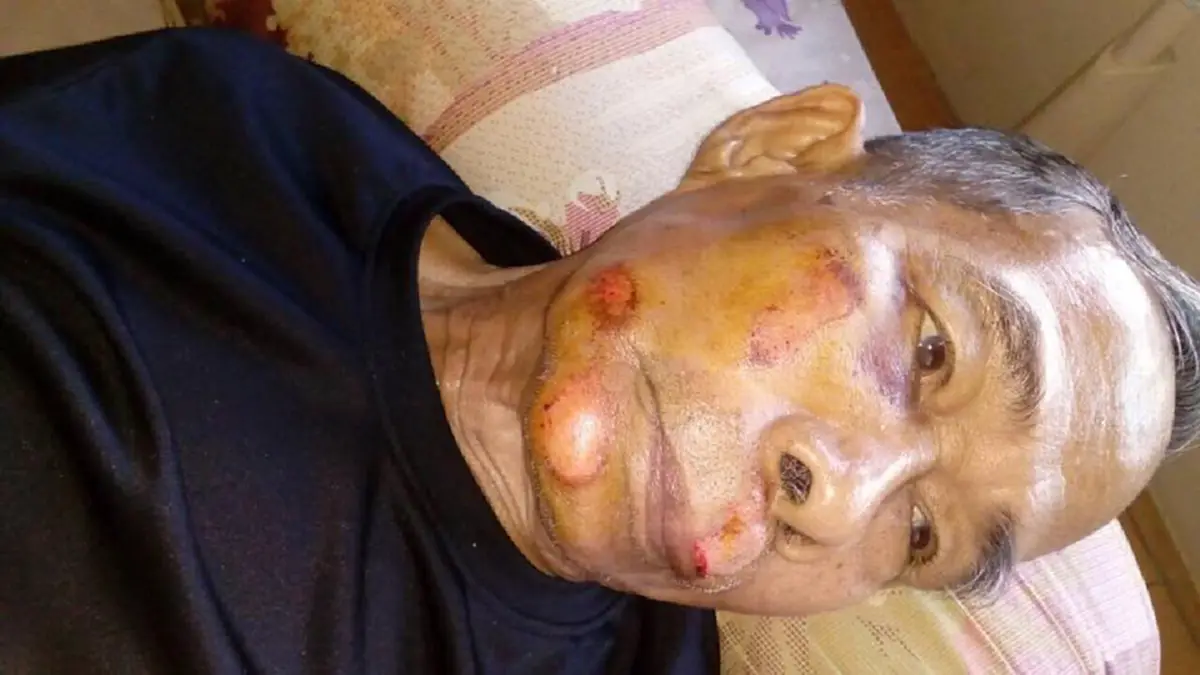 สองตายายที่โดนรถเบนซ์ชนจนได้รับบาดเจ็บ โดนเจ้าหน้าที่ตำรวจ ให้ไปหาหลักฐานมาเพิ่ม ขอทะเบียนรถชัดๆ หลังบอกทะเบียนไป ดันไปตรงกับลูกนักการเมือง?