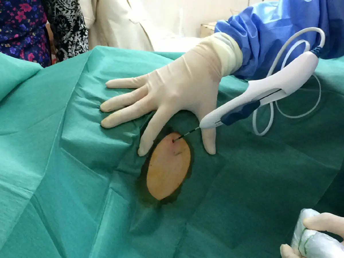 พนักงานออฟฟิศควรรู้ไว้ "14 โรคที่ประกันสังคมไม่จ่ายให้"  เจ็บปางตายก็ไม่ได้สิทธิ์ รีบเช็คด่วน!