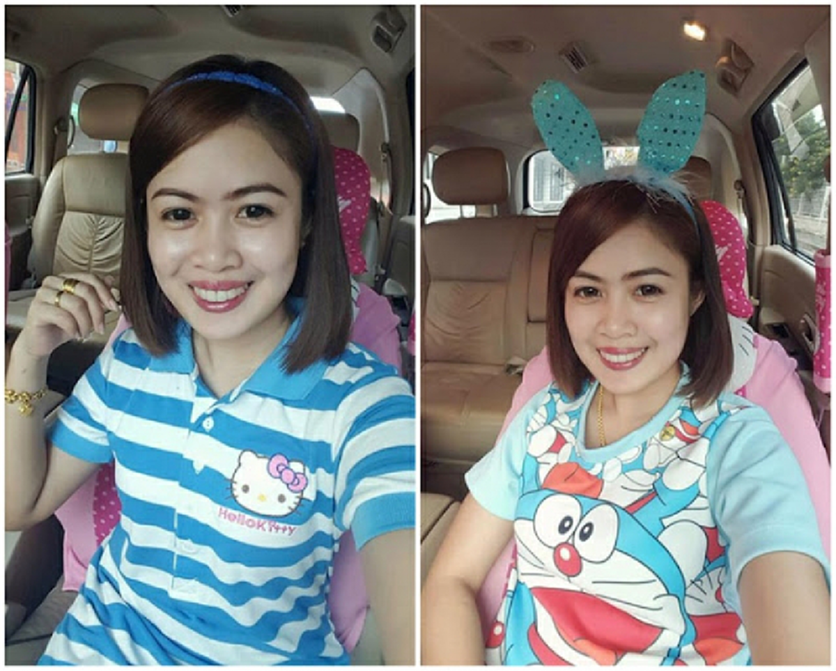 สาวโพสต์วิวัฒนาการจากหน้าบ้านๆฟันเหยิน ซ้อนเกไม่เรียงตัว สู่วันแจกยิ้มสดใสได้ไม่อายใคร