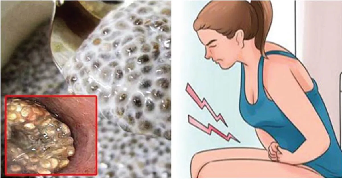 อย่ารอช้า!! 4 สูตรเครื่องดื่ม "ดีท็อกซ์" ล้างลําไส้ น้ำหนักลด สิวหาย ใน 3 วัน !!