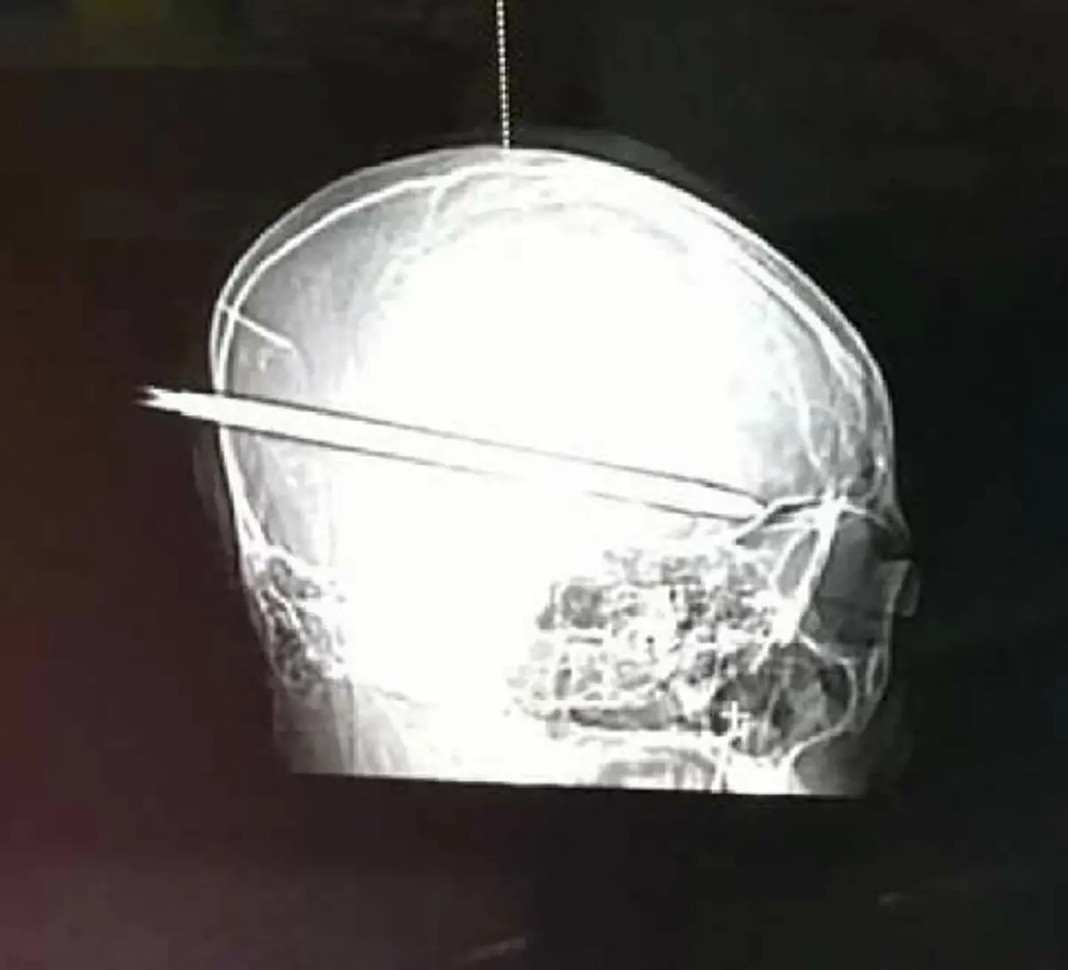 มาแล้วคลิปนาทีหมาหมู่อาละวาด!! เพจดังเปิดหลักฐานเด็ดแก๊งโจ๋ทมิฬยกพวกรุมฆ่า "น้องปอนด์" ตร.ยันใหญ่แค่ไหนก็จับ ล่าสุดจนมุมยกฝูงโผล่รับข้อหา??