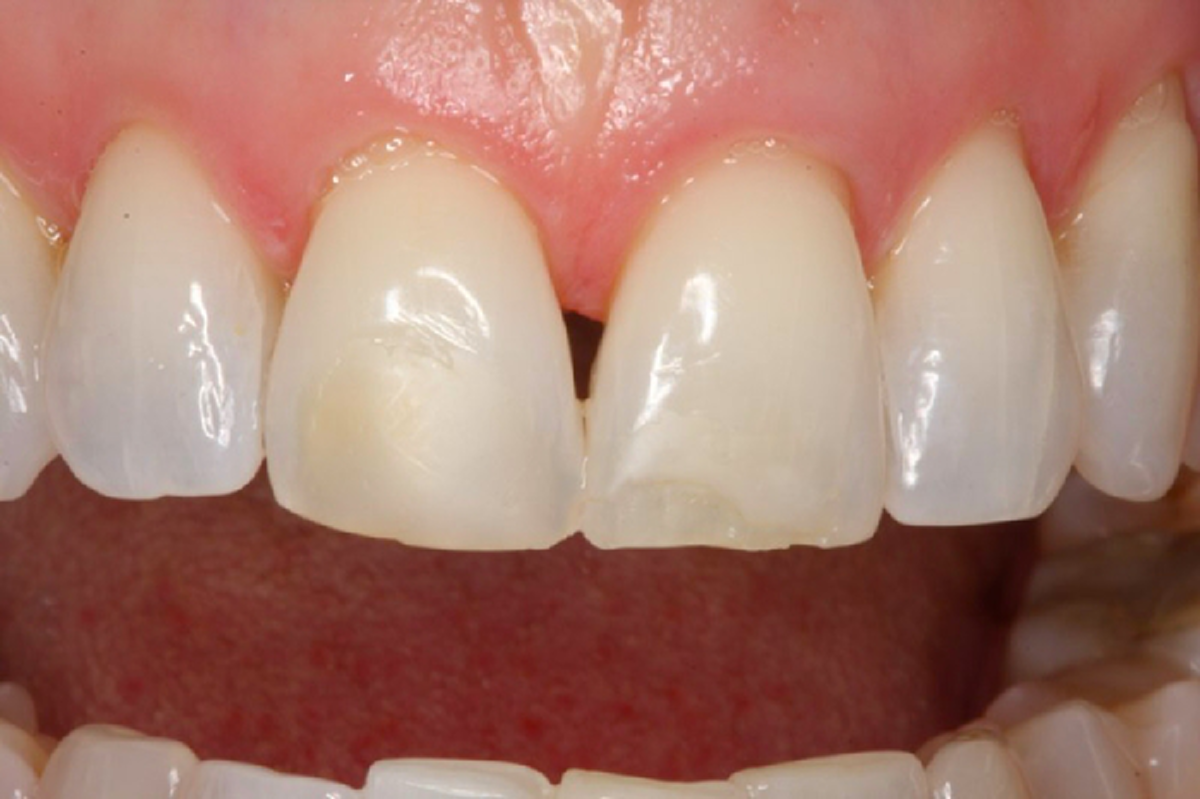 ควรระวัง !! กินน้ำส้มแล้วดีมีประโยชน์ แต่ก็อันตรายเหมือนกัน