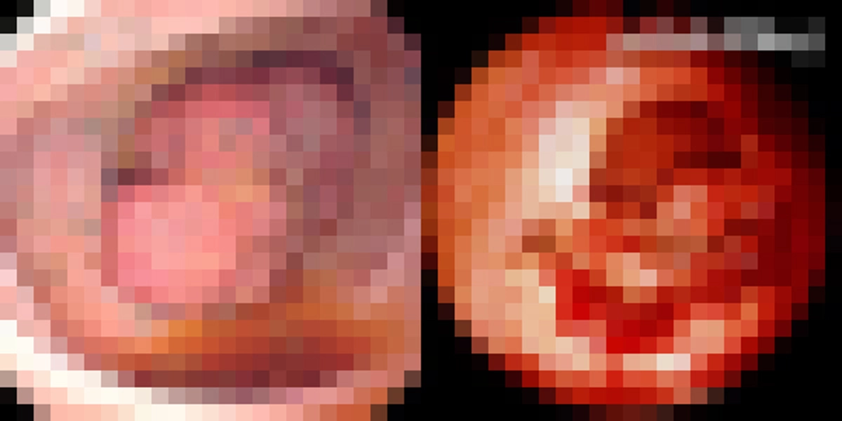 คนทำงานอ่านด่วนๆ!!! มะเร็งลำไส้ เพชฌฆาตในเงามืด โรคร้ายที่ต้องระวัง!!!