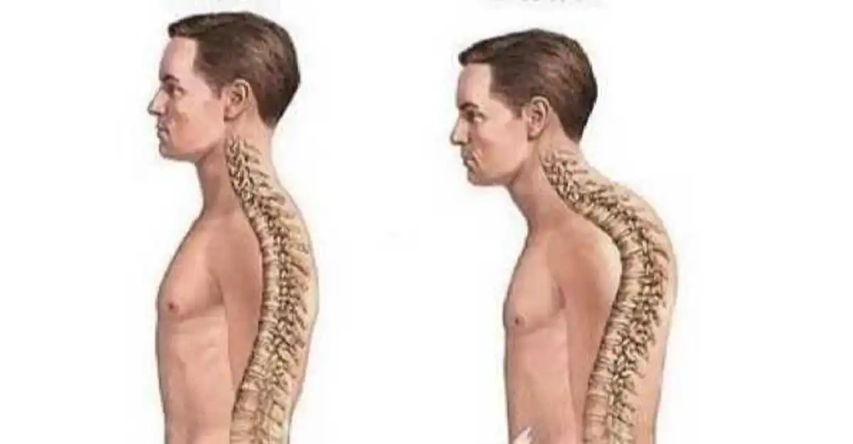 ไม่ต้องพึ้งหมอ!! แค่ทำท่านี้ อาการปวดหลัง ปวดคอ ปวดเอว จะหายทันที ลองเลย