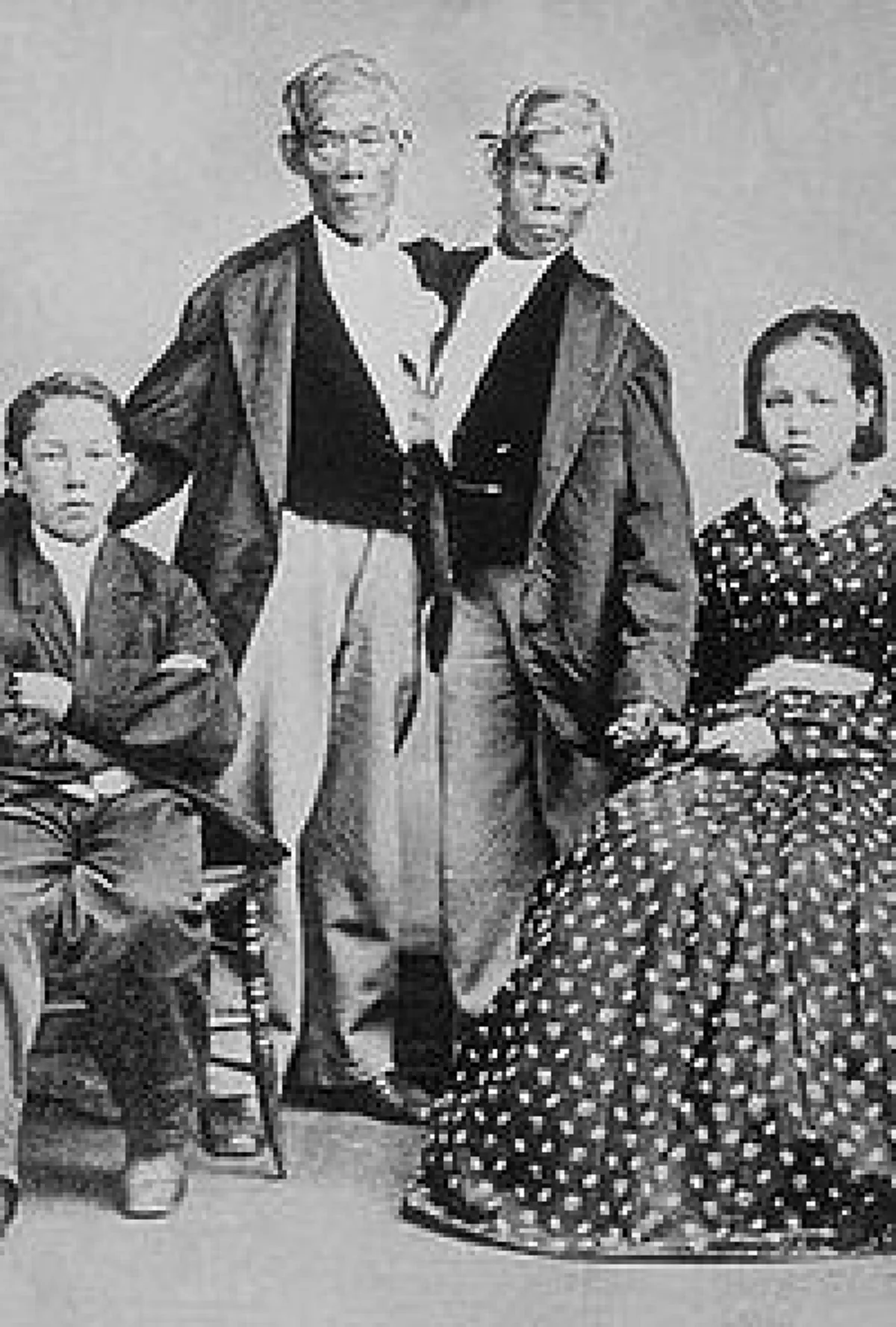 ตำนานแฝดสยามคู่แรกของโลก!!เผยสาเหตุการเสียชีวิตของ"อิน"ที่หลายๆคนอาจไม่เคยรู้มาก่อน เหตุใดจึงเป็นเวลาใกล้เคียงกันกับ"จัน"เเฝดผู้พี่