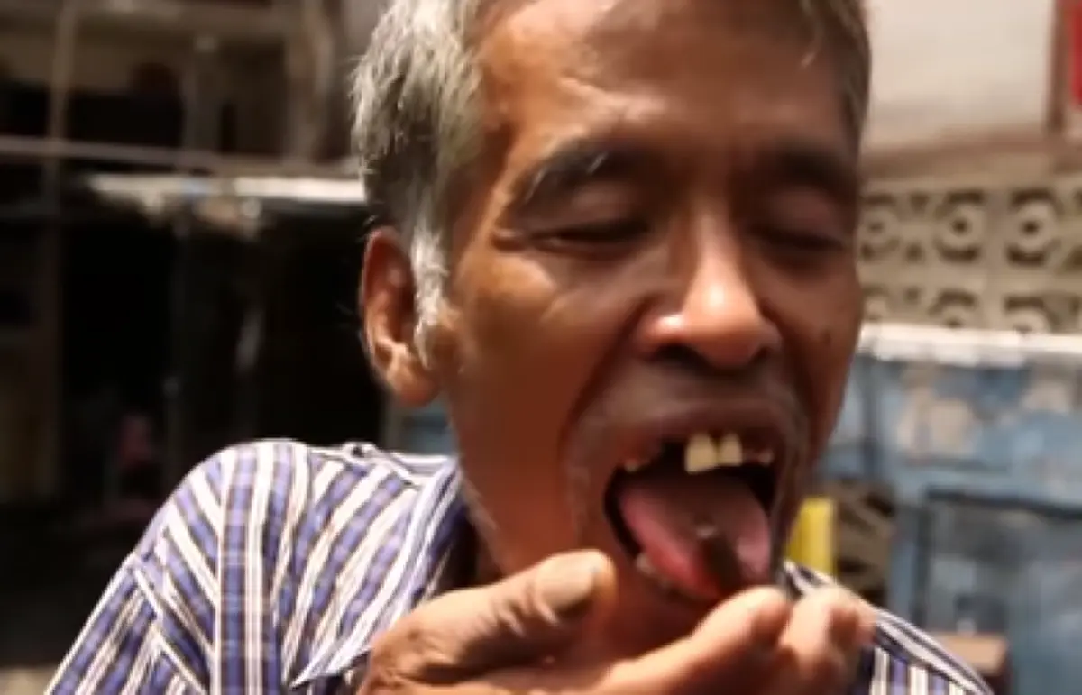 แมลงสาบกินไม่ได้นะจ๊ะ!! ลุงเลี้ยงนกพิราบ กินแมลงสาบโชว์ผู้สื่อข่าว บอกอีกว่ากินแล้วก็ไม่เป็นอะไร แต่หมอแพนด้าออกมาเตือน กินแล้วเสี่ยงเป็นโรค