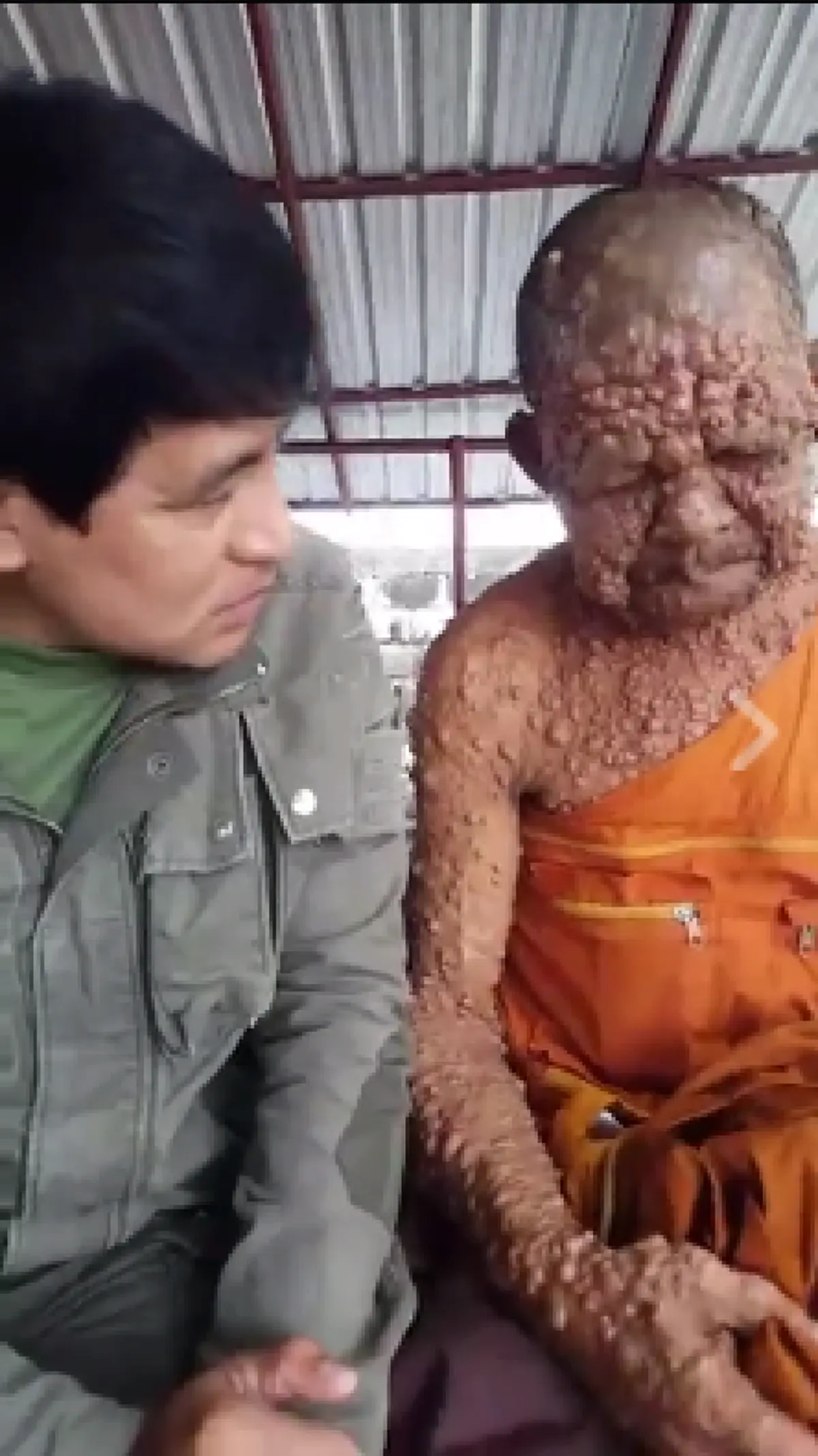 วอนช่วยเหลือ!! พระสงฆ์ “ป่วยเท้าแสนปม” ทรมานทั้งร่างกายและสภาพจิตใจ ขอความช่วยเหลือจากรัฐ “แต่ไม่มีใครสน” ซ้ำร้ายญาติโยมและพระรูปอื่นรังเกีย