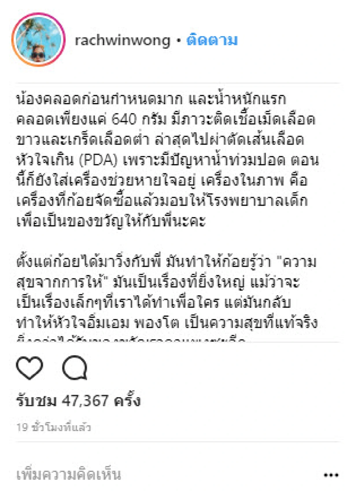 ***นับถือหัวใจของเธอ !!! "ก้อย รัชวิน" มอบของขวัญวันเกิดสุดยิ่งใหญ่ให้ "พี่ตูน" งานนี้ทำเอาชาวเน็ตดีใจแทน พากันน้ำตาไหลทั้งโซเชียล !?