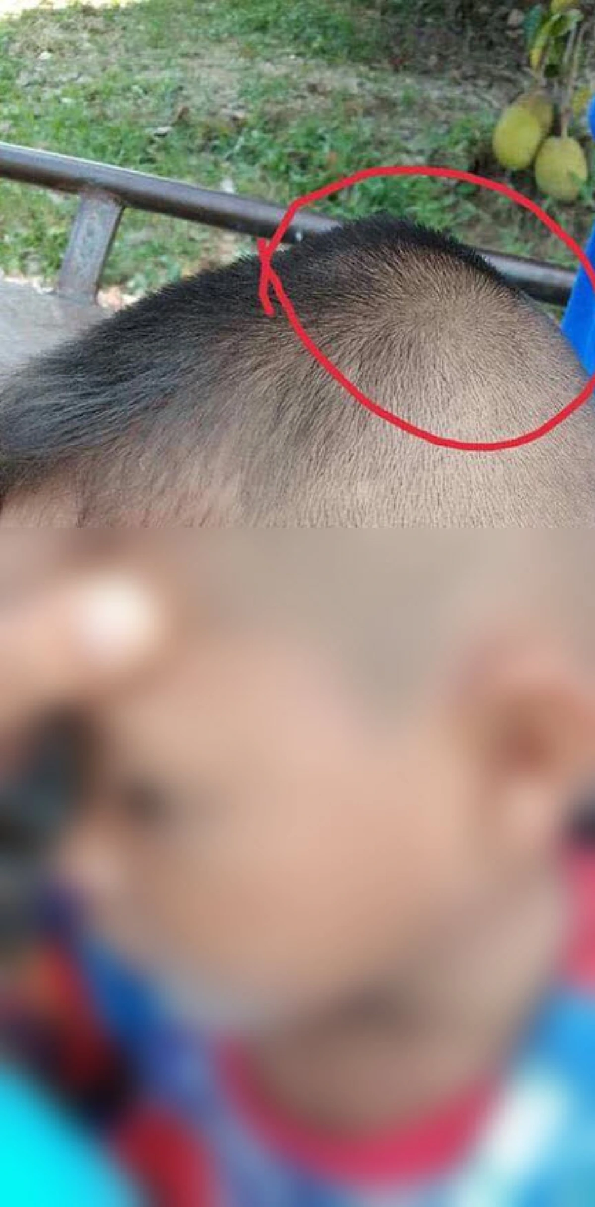 เเม่ร้อง ศูนย์พัฒนาเด็กเล็ก ลูกท้องเสีย ครูใช้ขันเคาะหัวปูดบวม!