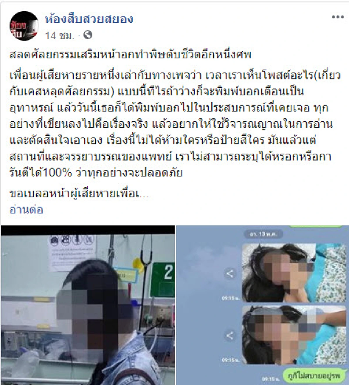 สาวเล่าอุทาหรณ์ หลังเพื่อนไปทำศัลยกรรมเสริมหน้าอก