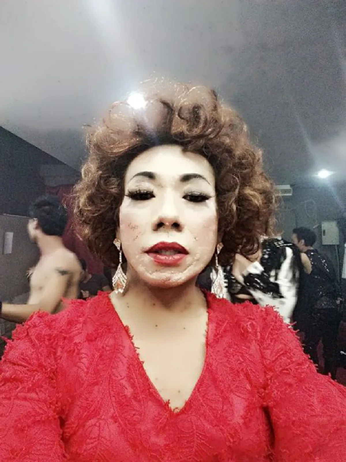 "ไข่มุก ซุปตาร์" ตลกดังป่วยมะเร็ง ล่าสุดขาเริ่มลีบ ไม่มีเงินรักษาตัวเเล้ว