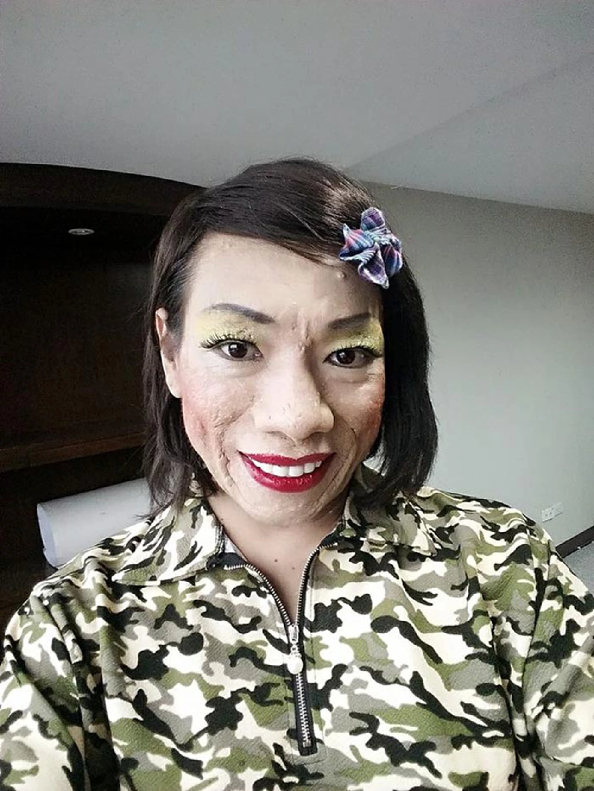 "ไข่มุก ซุปตาร์" ตลกดังป่วยมะเร็ง ล่าสุดขาเริ่มลีบ ไม่มีเงินรักษาตัวเเล้ว