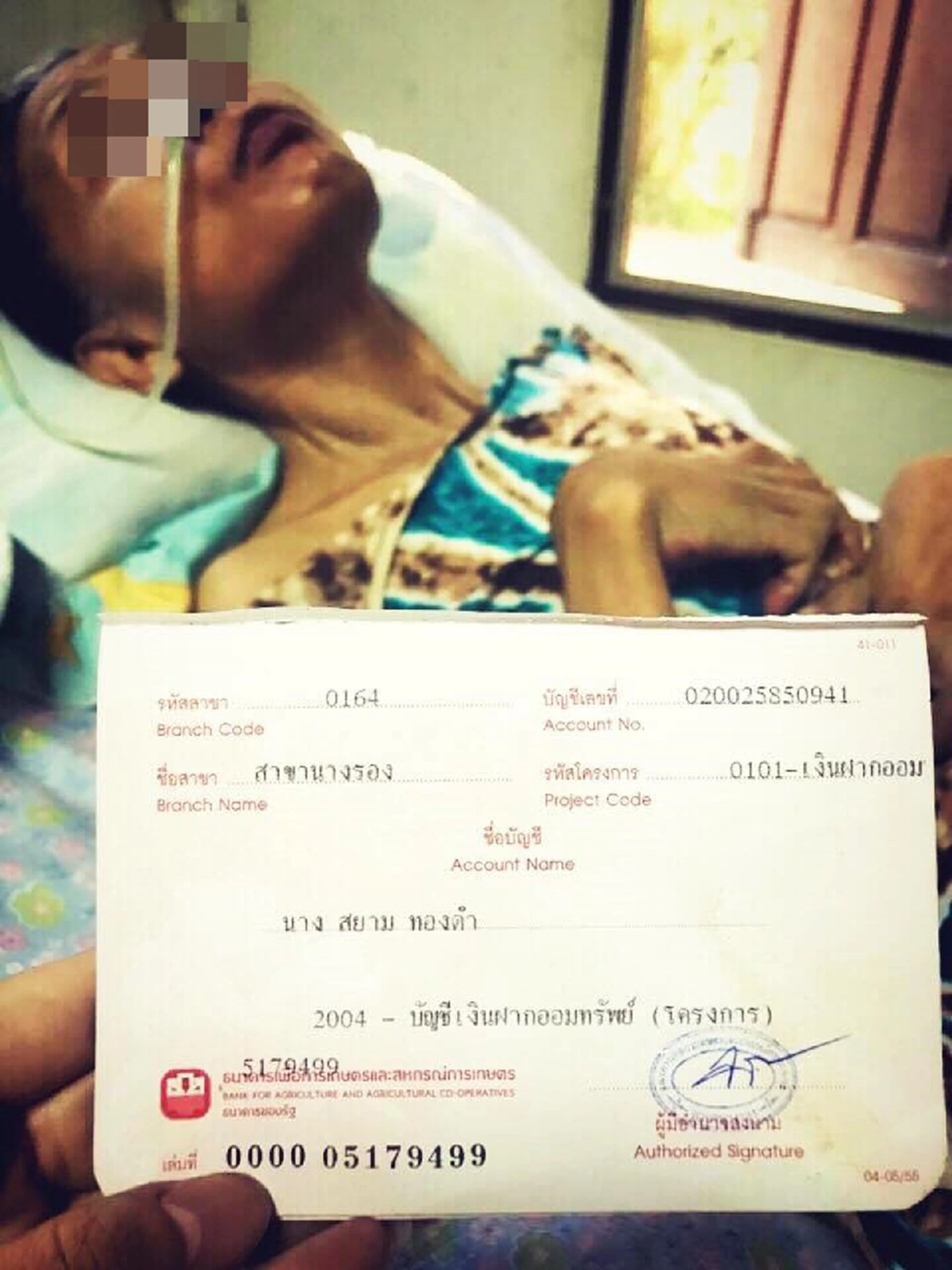 ขอคนล่ะ1แชร์! แม่พิมพ์ของชาติวัย 57ปี ทั้งชีวิตทุ่มเทให้กับการสอนเด็ก กลายเป็นผู้ป่วยพิการติดเตียงนานกว่า7ปี จากอุบัติเหตุหลังจากสอนหนังสือ!