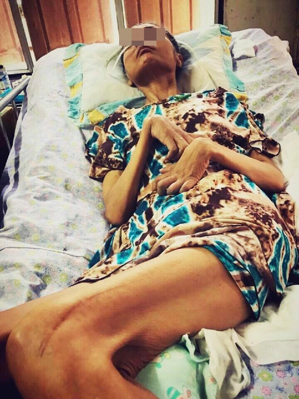 ขอคนล่ะ1แชร์! แม่พิมพ์ของชาติวัย 57ปี ทั้งชีวิตทุ่มเทให้กับการสอนเด็ก กลายเป็นผู้ป่วยพิการติดเตียงนานกว่า7ปี จากอุบัติเหตุหลังจากสอนหนังสือ!